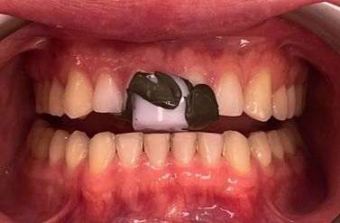 czym jest ekwilibracja