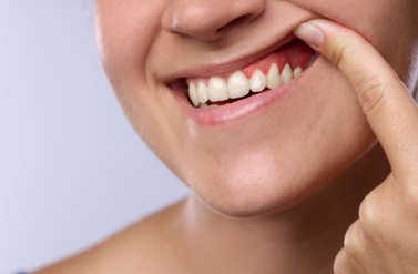periodontologia - jak zadbać o dziąsła